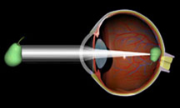 Normal eye's vision without cataracts